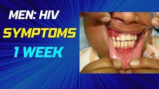 HIV symptoms in men after: 1 week