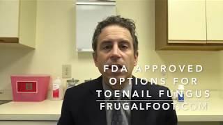 FDA Approved Options For Toenail Fungus