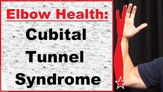 Elbow: Cubital Tunnel Syndrome