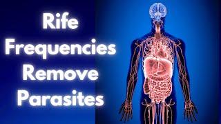 Parasites (General) & Worms - RIFE Frequencies - Remove Parasites Frequency - DETOX Parasites