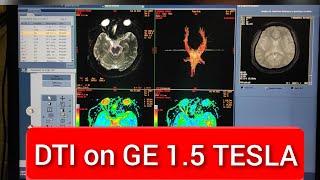 Diffusion Tensor Imaging (DTI) protocol, positioning and planning | Live Demo in English.
