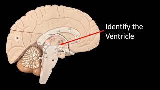 Anatomy of the Brain Model Virtual Practical Exam FLASH CARDS