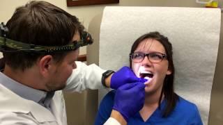 Canker Sore Treatment by Dermatologist Dr. David Myers
