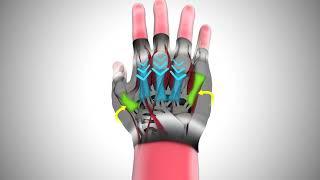 JLab Animation - Carpal Tunnel Syndrome