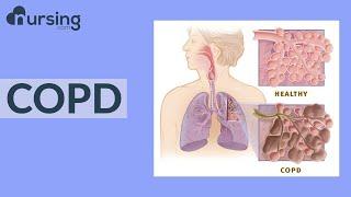 COPD (Nursing School Lessons)