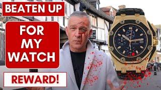 Beaten up for my Watch - SHOCKING TRUE STORY