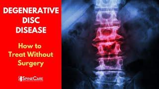 What is DEGENERATIVE DISC DISEASE? | How to Treat It WITHOUT SURGERY