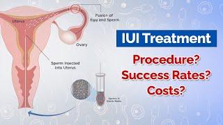 IUI Treatment: Procedure, Costs, Success Rates