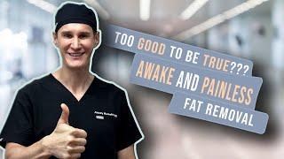 Awake and Painless Fat Removal: Too Good to be True???