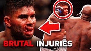 8 UFC Battles That Ended With Brutal Injuries | Mixed Martial Arts