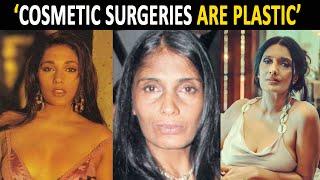 Anu Aggarwal: Had many surgeries after accident to survive. I feel cosmetic surgeries are plastic