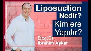 Liposuction Nedir Kimlere Uygulanır? / Doç.Dr.İbrahim Aşkar