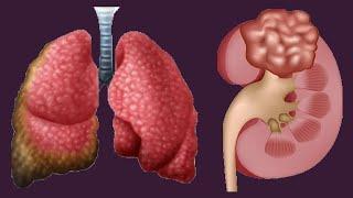 Low And High Hematocrit Levels: Causes And Symptoms