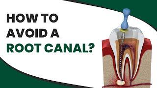 How to Avoid a Root Canal?