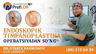 #BemorFikri bemorimiz #EndoskopikTimpanoplastika operatsiyasidan so'ng