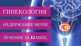 ЭФФЕКТИВНОЕ ЛЕЧЕНИЕ стрессового недержания мочи ЗА 15 МИНУТ. Система TVT-O!