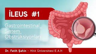 ILEUS  #1 - Dr. Fatih Şahin Anlatıyor