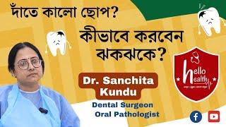 দাঁতে কালো ছোপ? | Black Spot in Tooth | #dentalproblems #dental #blackspots #toothpaste #toothcare