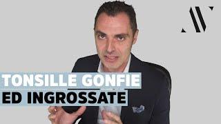 Tonsille gonfie ed ingrossate