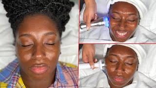 MUST WATCH DERMAPLANE! | Dermaplaning Facial + Cold Therapy