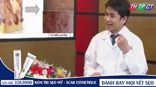 Kem trị sẹo Scar Esthetique | Kem trị sẹo Mỹ