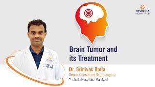 Brain Tumor and its Treatment | Yashoda Hospitals Hyderabad