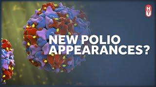 A Polio Case in the United States. What Does it Mean?