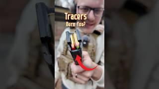 Do Tracers Burn INSIDE Of You? (Ballistic Test)