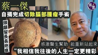 57歲蔡一傑親述完成切除腦部腫瘤手術 頭顱留長長疤痕 感激醫生幫助 能重新站起來：我相信我往後的人生一定更精彩丨錄音訪問丨草蜢（#蔡一傑 #草蜢 #娛壹）