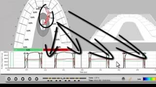 T-Scan Scanning Techniques