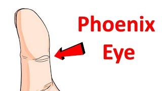 Do you have Phoenix Eye in your thumb?