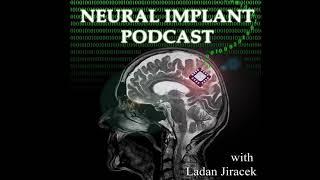 Phil Kennedy Discusses Being Implanted with His Own Silent-Speech Neural Recording Device