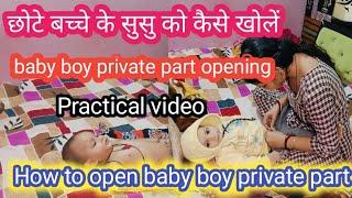 How to open baby boy private part with prectical | छोटे बच्चे के सुसु को कैसे खोलें @Rubyvlogs21