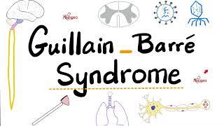 Guillain-Barré Syndrome - Acute Inflammatory Demyelinating Polyradiculoneuropathy “AIDP”- Neurology