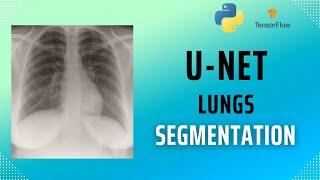 How to segment X-Ray lungs using U-Net and Tensorflow