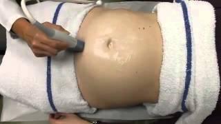 Ultrasound in Obstetrics & Gynecology: A Practical Approach - Clip 10.6