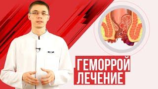 геморрой лечение, диагностика, полезные советы