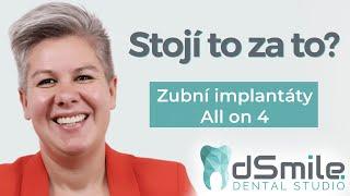 Změňte život jednou návštěvou! Jak probíhá implantace zubů?