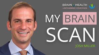 What my SPECT scan taught me about my brain health with Josh Miller | E95