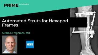 Automated Struts for Hexapod Frames - Austin T. Fragomen, MD