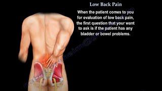 Low Back Pain - Disc Herniation, which type is concerning.