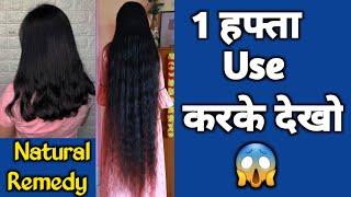 Extreme HAIR GROWTH CHALLENGE with home remedy - Get Longer, Stronger and Thicker Hair | RuntiMe