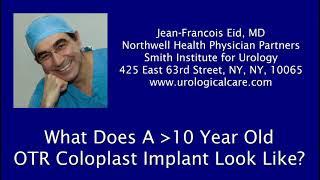 What does a great than 10 year old Coloplast OTR Implant look like?