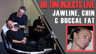 FULL JAWLINE TREATMENT. Dr Tim Injects Jawline, Chin & Buccal Fat Live [Aesthetics Mastery Show]