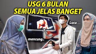 HIDUNGNYA MANCUNG.. USG 6 BULAN ANAKKU..