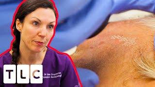 Mysterious Dark Spots Have Been Misdiagnosed! | The Bad Skin Clinic