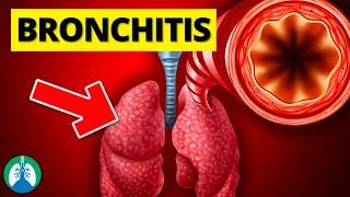 Bronchitis (Medical Definition) | Quick Explainer Video