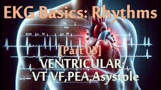 EKG Series [05 of 07] Rhythms - Ventricular Rhythms (10 minutes of practice questions!)