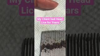 Head Lice for Years  l Lice Removal Service @staceythelouselady #explore #lice #hair