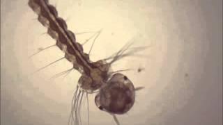 Terrifying mosquito larva under microscope